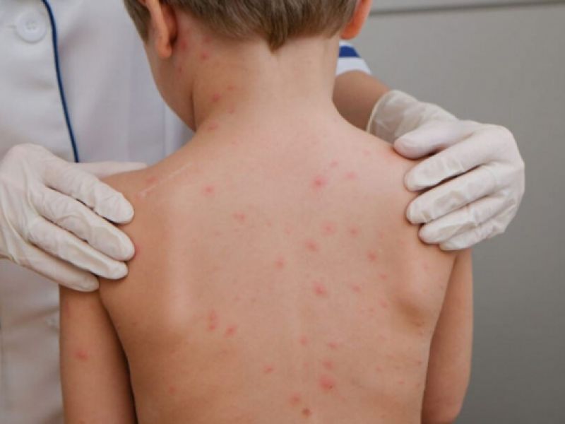 Hier passiert es – Hirnhautentzündung: Der Infektionsspezialist klärt den Hauptverdacht der ...